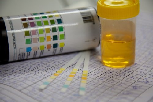 Proteinuria Treatment